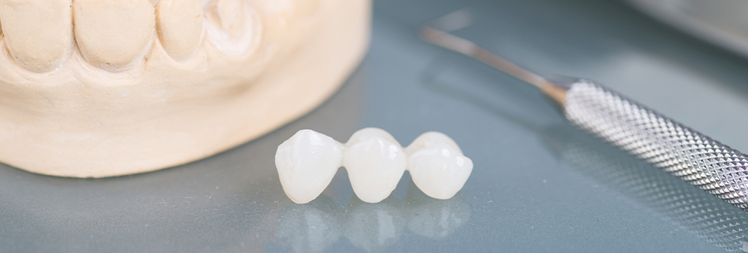 歯科技工士在籍で入れ歯・詰め物の精度アップ